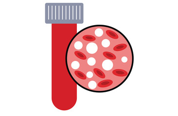 leukemia. Blood cancer. Red and white blood cells. Isolated vector illustrations in cartoon style.normal blood and leukemia.Red and white Blood,Leukemia icon. White and red blood cells,red