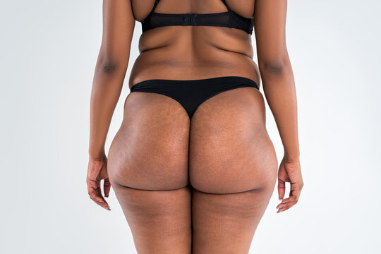 Overweight black African woman with fat hips and buttocks, obesity female body with cellulite and stretch marks on gray background