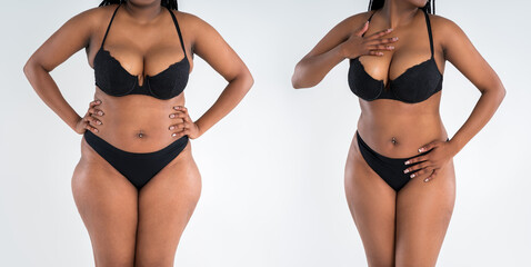 Tummy tuck, fat body before and after weight loss and liposuction on gray background, black African woman, plastic surgery concept