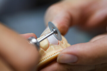 Precision Craftsmanship in Prosthodontics