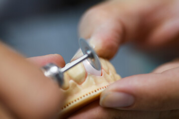 Precision Craftsmanship in Prosthodontics