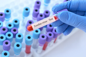 Doctor holding a test blood sample tube with Zombie virus test on the background of medical test tubes with analyzes.