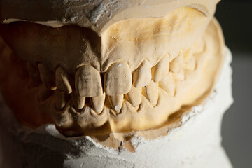 The image of a denture	