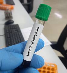 Blood sample for Phenytoin test, therapeutic drug, to maintain a therapeutic level and diagnose...