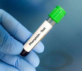 Blood sample for Phenytoin test, therapeutic drug, to maintain a therapeutic level and diagnose...