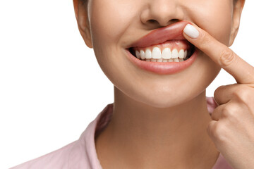 Woman showing her clean teeth on white background, closeup