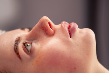 Naklejka premium close-up of a client's face during health rejuvenation beauty procedure in a beauty salon skin care