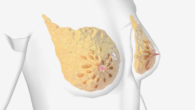 The breast is an apocrine gland that produces the milk used to feed an infant .