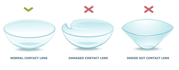 Normal contact lens, damaged contact lens, inside-out contact lens. How to check the lens. Infographic. Healthcare illustration. Vector illustration. 