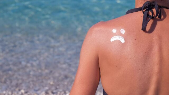Shoulder with sunblock on the hot shore. A view of female traveler shoulder make a sad smile with lotion on hot red skin. A concept of sunburned woman shoulders on the luxury beach.