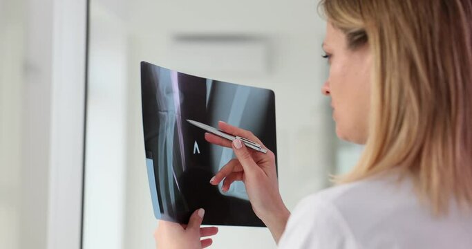 Female doctor examines x-rays of patient arm bones