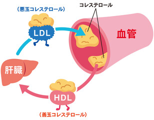 LDLとHDLの仕組み　脂質異常症　血管　コレステロール