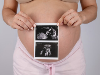 A pregnant woman holds a photo from an ultrasound screening against the background of a bare belly. 