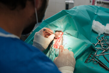Doctor performing a surgical intervention, exploratory laparotomy. Concept: hospital, medicine