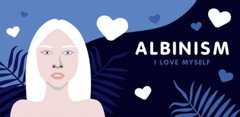 Banner about albinism with young woman with European appearance minimalistic illustration