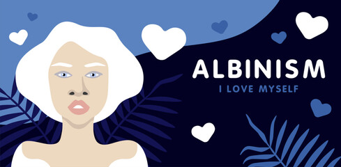 Banner about albinism with young beautiful African American woman minimalistic illustration