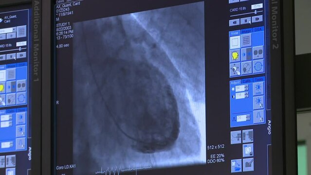 Cardiac scan  of chambers, valves, blood vessels and heart performance