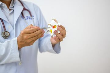 An orthopedic surgeon holds a spinal model as he demonstrates treatment methods for human spinal injuries caused by back pain during a medical consultation