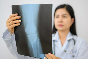 Asian female orthopedic surgeon in white uniform holds orthopedic x-ray disc Diagnosing bones and...