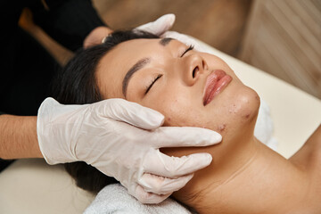 facial treatment for acne-prone skin, masseuse in latex gloves and asian woman with closed eyes