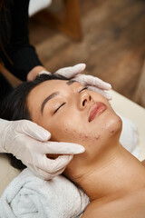 facial massage for acne-prone skin, masseuse in latex gloves and asian woman with closed eyes