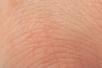 Texture of healthy skin as background, macro view