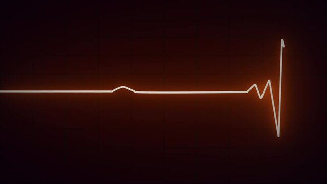 Heartbeat icon Sinus bradycardia.