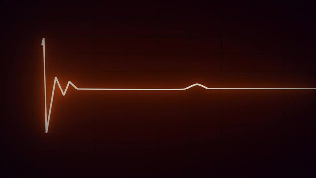 Heart beat Electrocardiogram