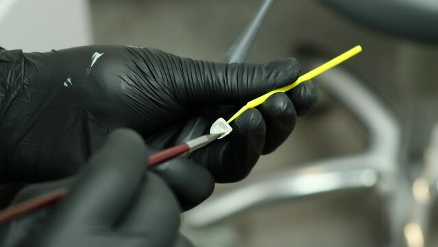 The use of hydrofluoric acid for ceramic veneers