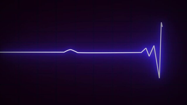 Sinus arrhythmia heartbeat rhythm, illustration Electrocardiogram