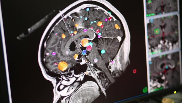 Image with human brain parts 3D modeling on the computer monitor 