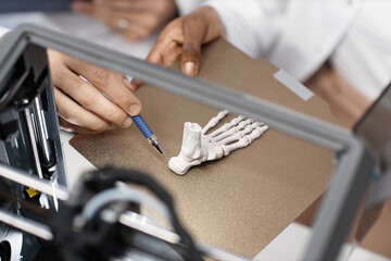 Close up shot of unrecognizable technicians hand pointing pen at calcaneus of printed 3D foot bone...