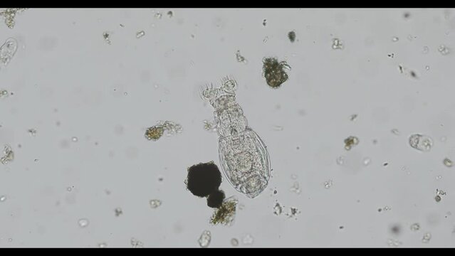rotifera of the family Habrotrochidae under the microscope - light microscope x200 magnification