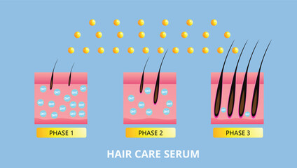 Hair care serum , hair Transplantation, vector design