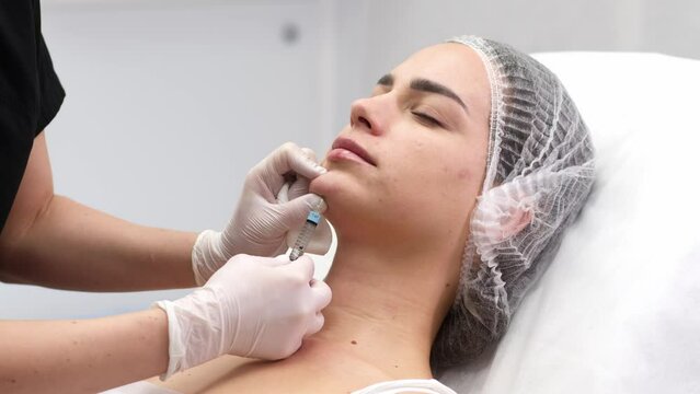 A cosmetologist wearing medical gloves performs a cosmetic procedure to enlarge the chin and correct the face. Video for a beauty salon. Concept of cosmetic injection procedures