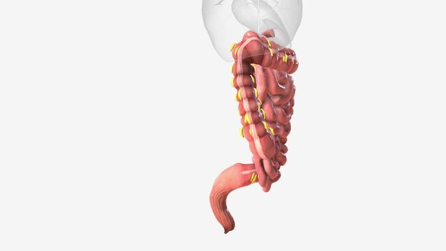 Epiploic appendages are normal outpouchings of peritoneal fat on the anti-mesenteric surface of the colon .