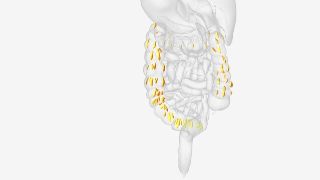 Epiploic appendages are normal outpouchings of peritoneal fat on the anti-mesenteric surface of the colon .