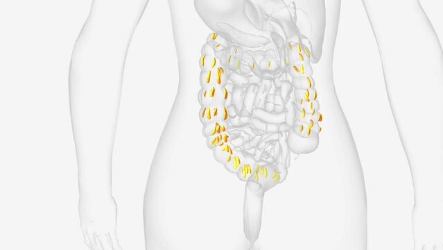 Epiploic appendages are normal outpouchings of peritoneal fat on the anti-mesenteric surface of the colon .