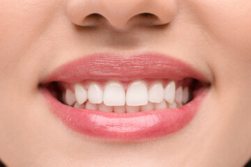 Woman with clean teeth smiling, closeup view