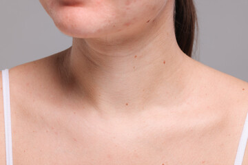 Naklejka premium Closeup view of woman with normal skin on grey background