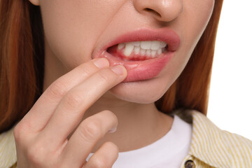 Fototapeta premium Woman showing her clean teeth on white background, closeup
