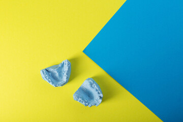Blue plaster impression of a patient's dental jaw with crooked teeth and malocclusions on a yellow...