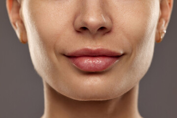 Reducing mimic wrinkles. Cropped image of female face, nose and lips against studio background....
