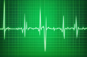 white line cardiogram on a green background with a heart in the middle