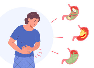 Diseases of stomach. Stomach pain, gastritis, heartburn. Gastric acid reflux, gastric bloating.