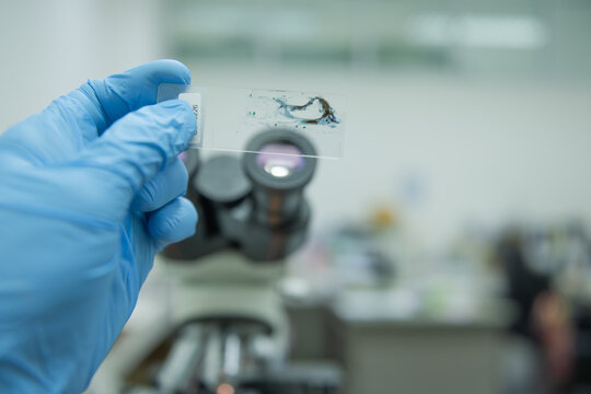 A pathologist is making a diagnosis from a slide of a specimen.