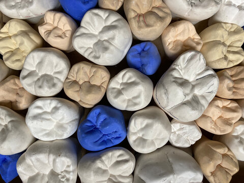 Occlusal surfaces of large-scale plaster premolars and molars