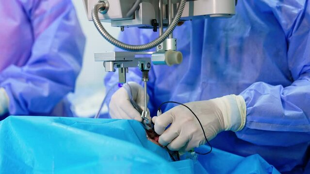 Modern surgery on eye for vision correction. Unrecognized surgeon holds the tool devices in the eye under microscope.