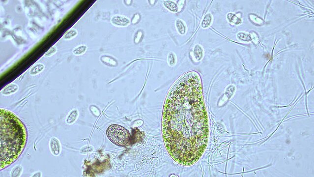 fresh water ciliate, Paramecium bursaria, surrounded by smaller ciliates and bacteria. 400x magnification, phase contrast microscopy