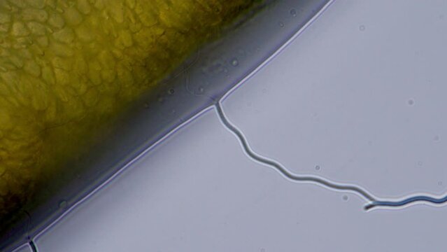 rare footage of sea anemone shooting urticating nematocysts and releasing toxing under the microscope. 200x magnification